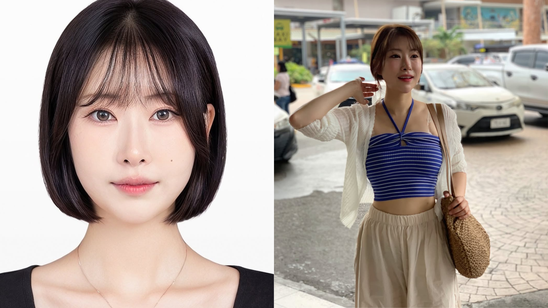 Lee Se Young Reveals Breast Filler Nightmare That Left Her Almost Paralyzed After Workout Wreck