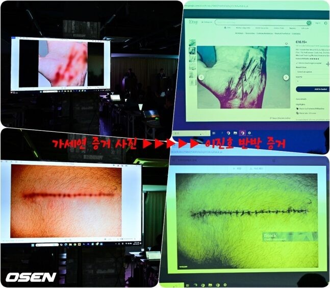 fake informant’s injuries